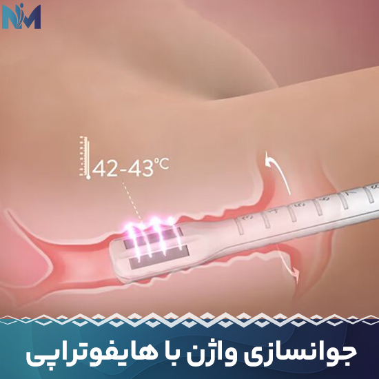 جوانسازی-واژن-با-هایفوتراپی