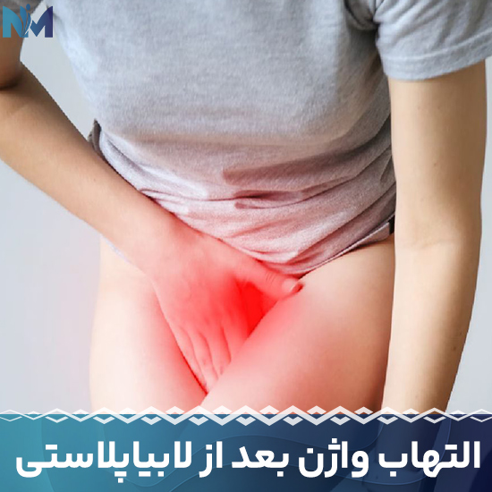 التهاب-واژن-بعد-از-لابیاپلاستی