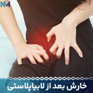 خارش-بعد-از-لابیاپلاستی
