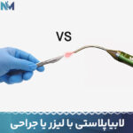 لابیاپلاستی-با-لیزر-یا-جراحی