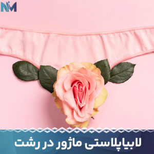 لابیاپلاستی-ماژور-در-رشت