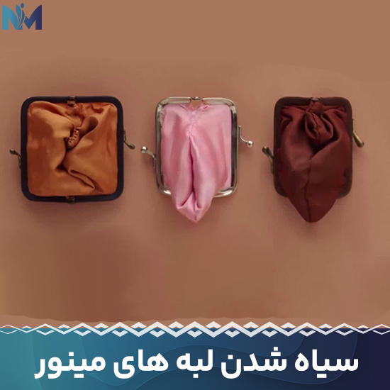 سیاه-شدن-لبه-های-مینور
