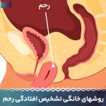 روشهای-خانگی-تشخیص-افتادگی-رحم