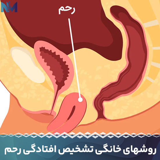 روشهای-خانگی-تشخیص-افتادگی-رحم