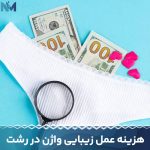 هزینه-عمل-زیبایی-واژن-در-رشت