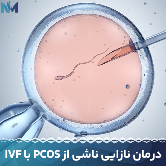 درمان-نازایی-ناشی-از-PCOS-با-IVF