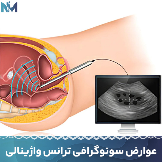 عوارض-سونوگرافی-ترانس-واژینالی