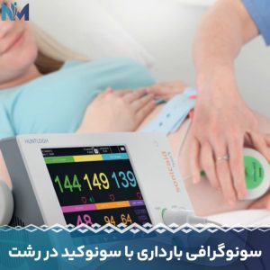 سونوگرافی-بارداری-با-سونوکید-در-رشت