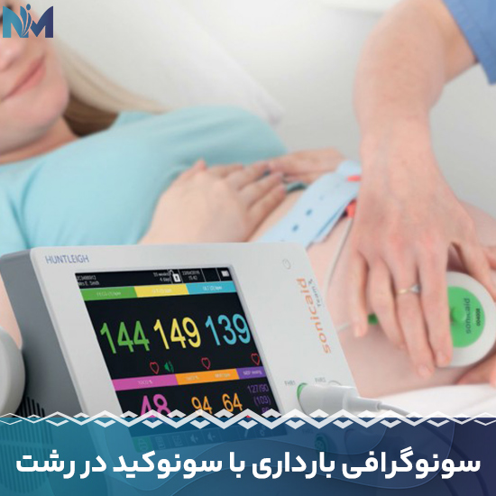 سونوگرافی-بارداری-با-سونوکید-در-رشت