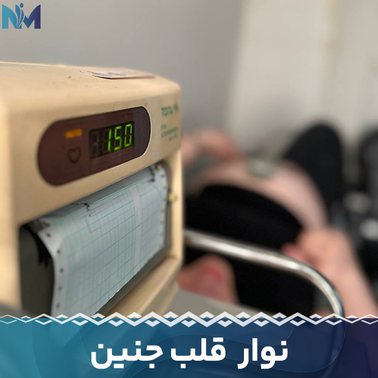 نوار-قلب-جنین