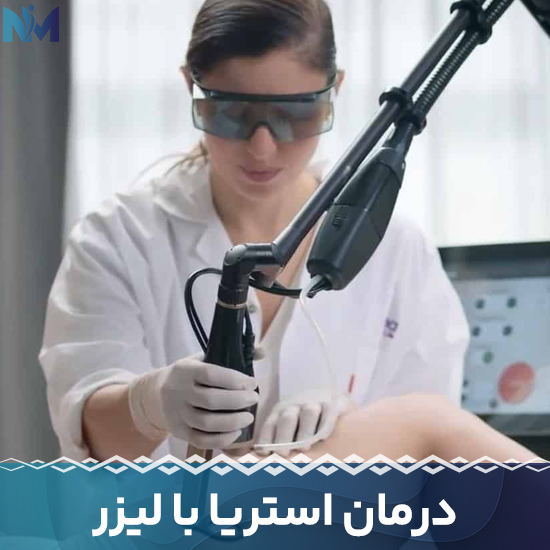 درمان-استریا-با-لیزر