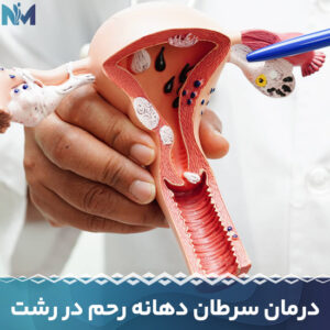درمان-سرطان-دهانه-رحم-در-رشت
