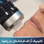 کلینیک-آر-اف-فرکشنال-در-رشت