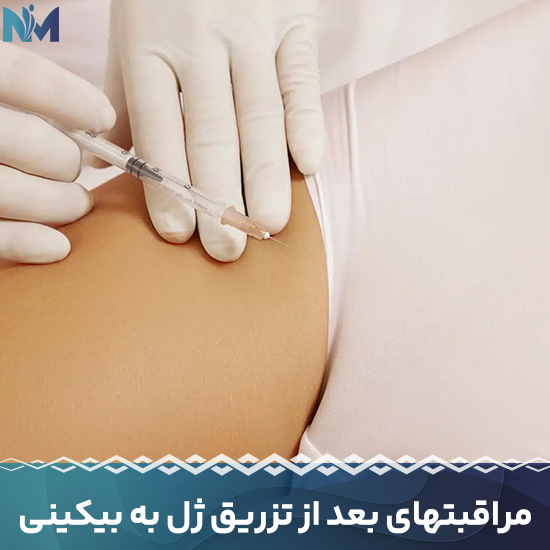 مراقبتهای-بعد-از-تزریق-ژل-به-بیکینی