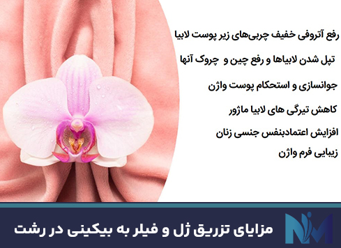 مزایای-تزریق-ژل-و-فیلر-به-بیکینی-در-رشت