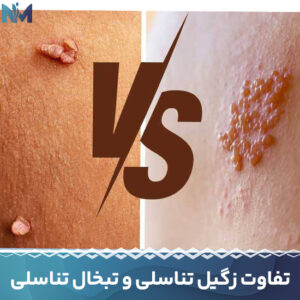 تفاوت-زگیل-تناسلی-و-تبخال-تناسلی