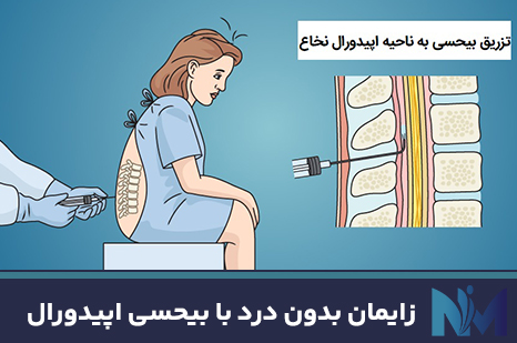 زایمان-بدون-درد-با-بیحسی-اپیدورال