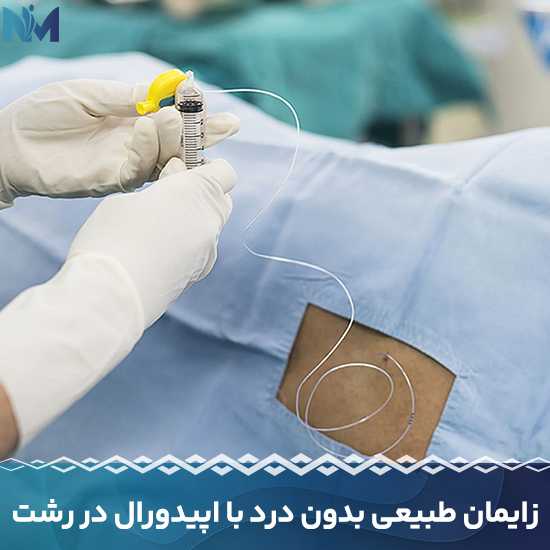 زایمان-طبیعی-بدون-درد-با-اپیدورال-در-رشت
