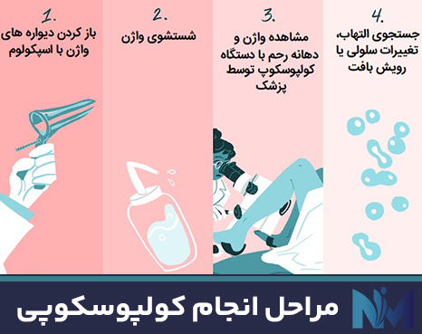 مراحل-انجام-کولپوسکوپی