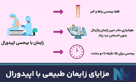 مزایای-زایمان-طبیعی-با-اپیدورال