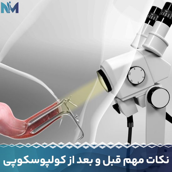 نکات-مهم-قبل-و-بعد-از-کولپوسکوپی